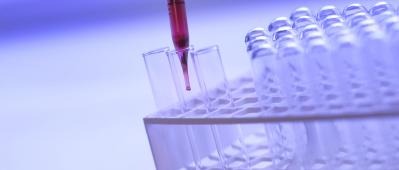img analisi residui contaminanti 2 agriparadigma